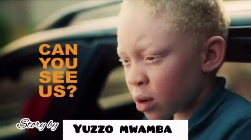 Yuzzo Mwamba Story Ya Albino